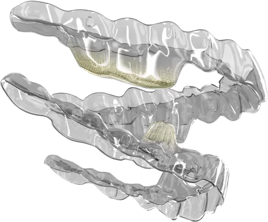 什麼是Smartee GS?