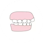 Flared teeth