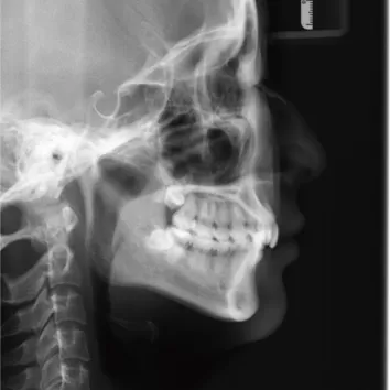 X-rays before treatment