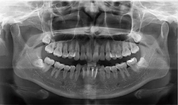 X-rays before treatment