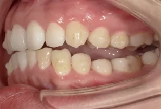 Intraoral photos