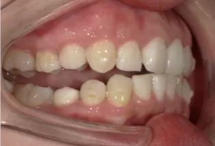 Intraoral photos