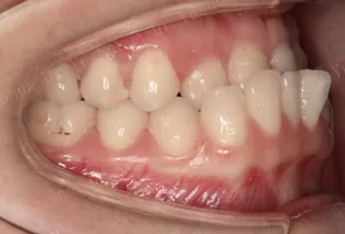 Intraoral photos