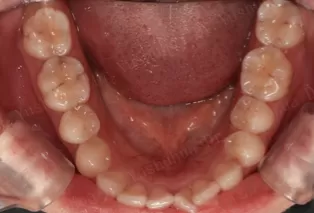 Intraoral photos
