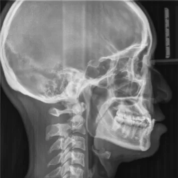 X-rays before treatment