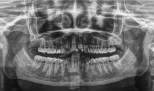 X-rays before treatment