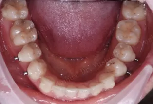 Intraoral photos