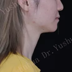 Facial photos before treatment