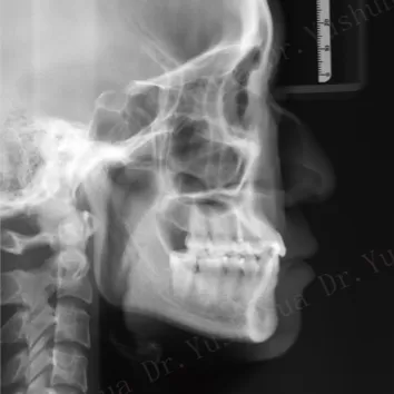 X-rays before treatment
