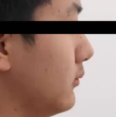 Facial photos before treatment