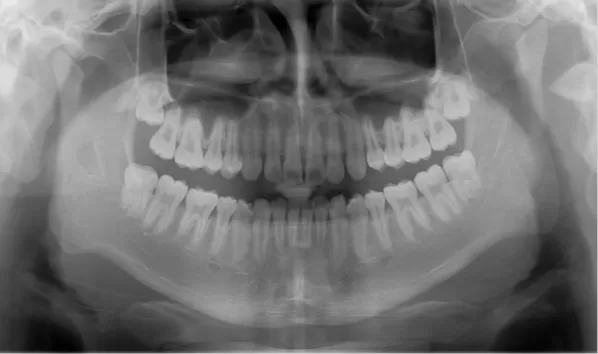 X-rays before treatment