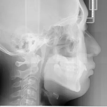 X-rays before treatment