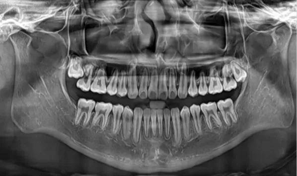 X-rays before treatment