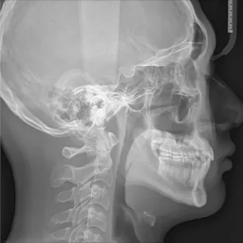 X-rays before treatment
