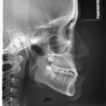 X-rays before treatment