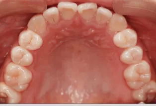 Intraoral photos
