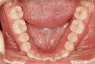 Intraoral photos