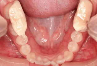 Intraoral photos