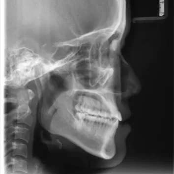 X-rays before treatment