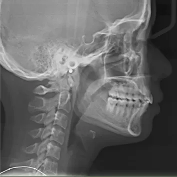 X-rays before treatment