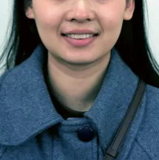 Facial photos before treatment