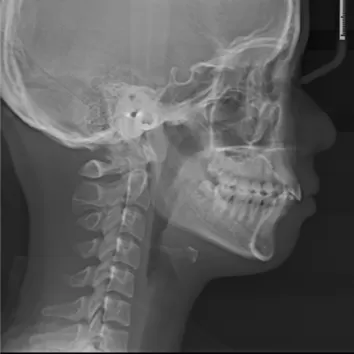 X-rays before treatment