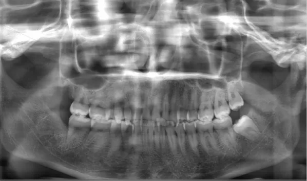 X-rays before treatment
