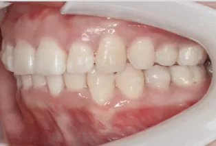 Intraoral photos