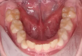 Intraoral photos