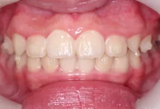 Intraoral photos