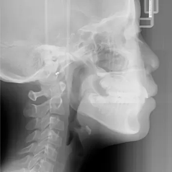 X-rays before treatment