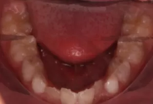 Intraoral photos