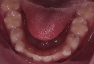 Intraoral photos