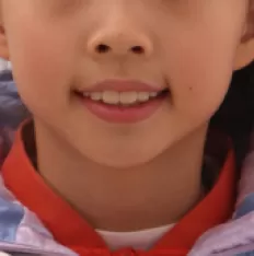 Facial photos before treatment