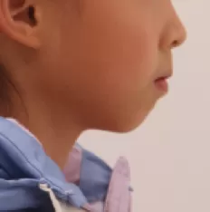 Facial photos before treatment